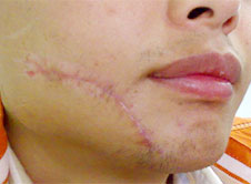 ݷƤҽԺ