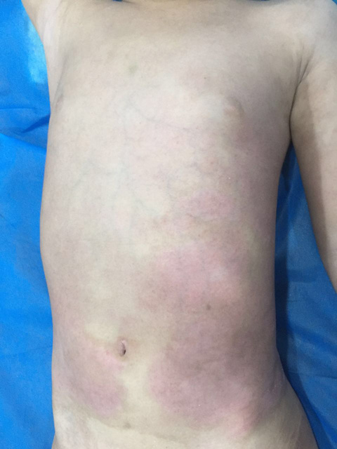 广州肤康皮肤病医院